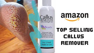 I Tested 's Best Selling Callus Remover Gel ➤ Dominique