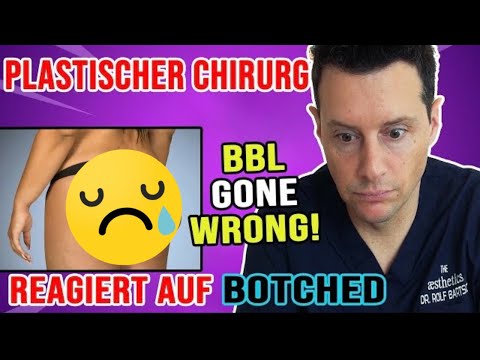 Verformter Po nach Brazilian Butt Lift (BBL)?! Plastischer Chirurg reagiert