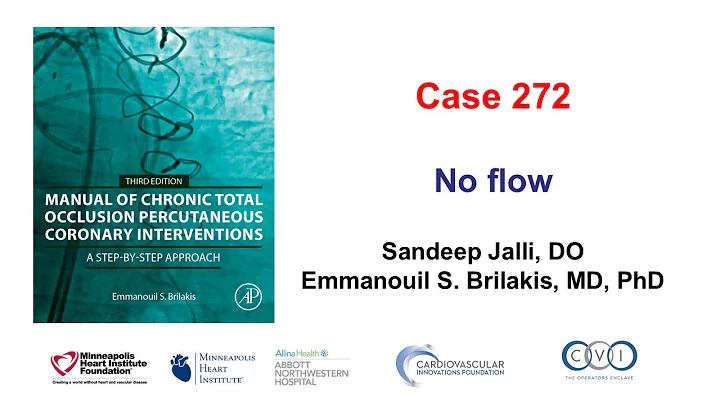 Case 272: Manual of CTO PCI - No flow