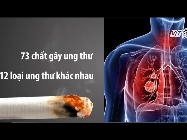 (VTC14)_Thuốc lá - sát thủ hàng đầu gây ung thư phổi