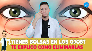 ¿Puede el botox combatir las bolsas de los ojos?