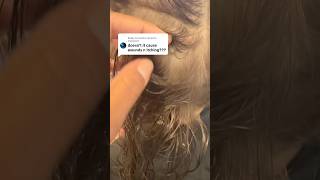 Lice removal treatment