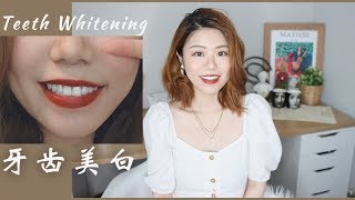 我如何美白牙齿+保持牙齿健康?How I Whiten my Teeth | Sylvia黄瓜瓜