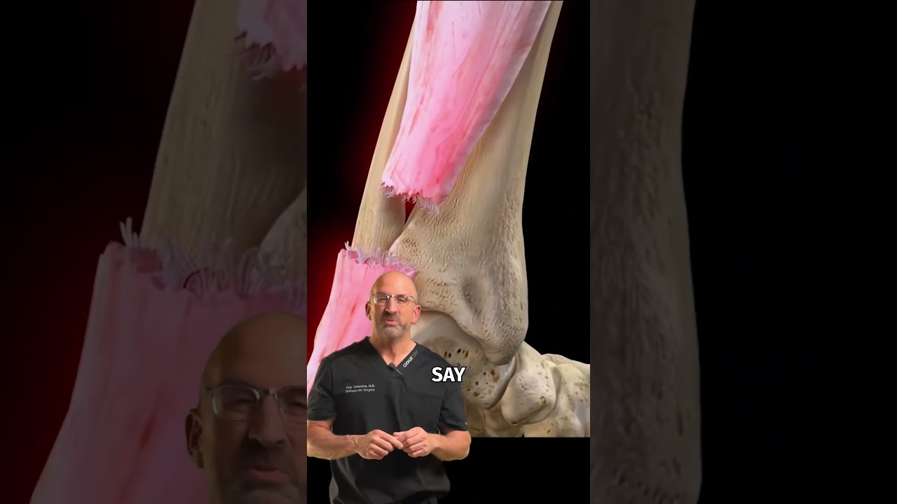 Largest + Most Common Tendon Rupture: Achilles Injury 