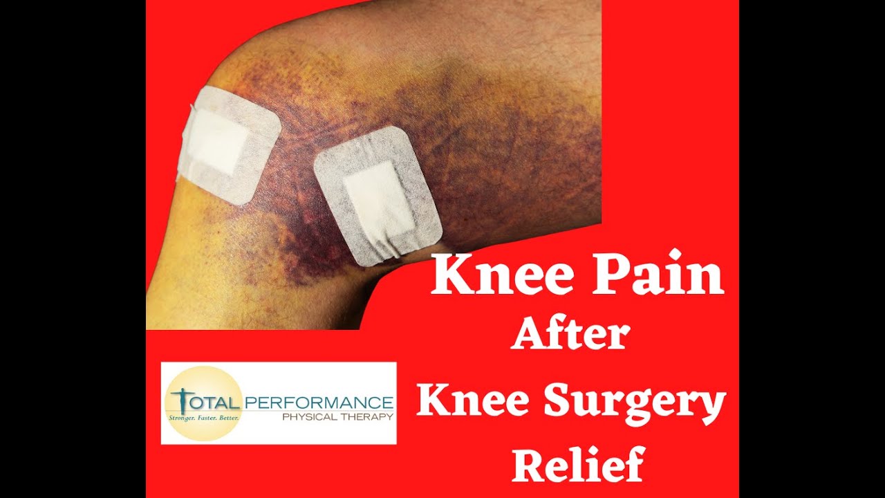 Knee pain after surgery relief YouTube