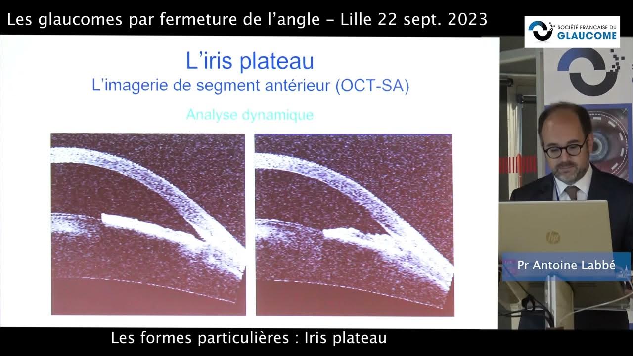 Iris plateau Pr Antoine Labbé YouTube