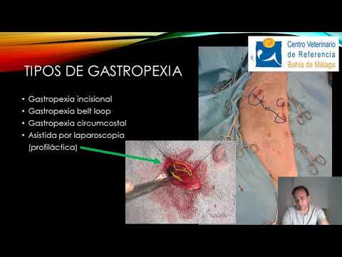 Video: ¿Cuándo hacer la gastropexia?