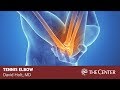 Tennis Elbow Symptoms, Diagnosis, and Treatment