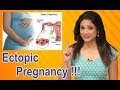 How Ectopic Pregnancy happens, how to prevent it ?