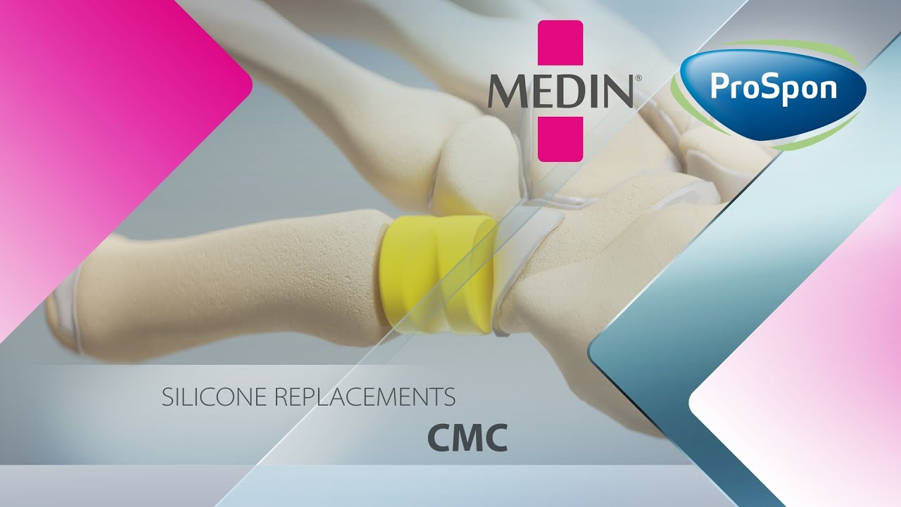 CMC joint replacement