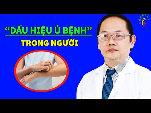 Video: Tại Sao Ngực Bị Ngứa: Các Dấu Hiệu Dân Gian