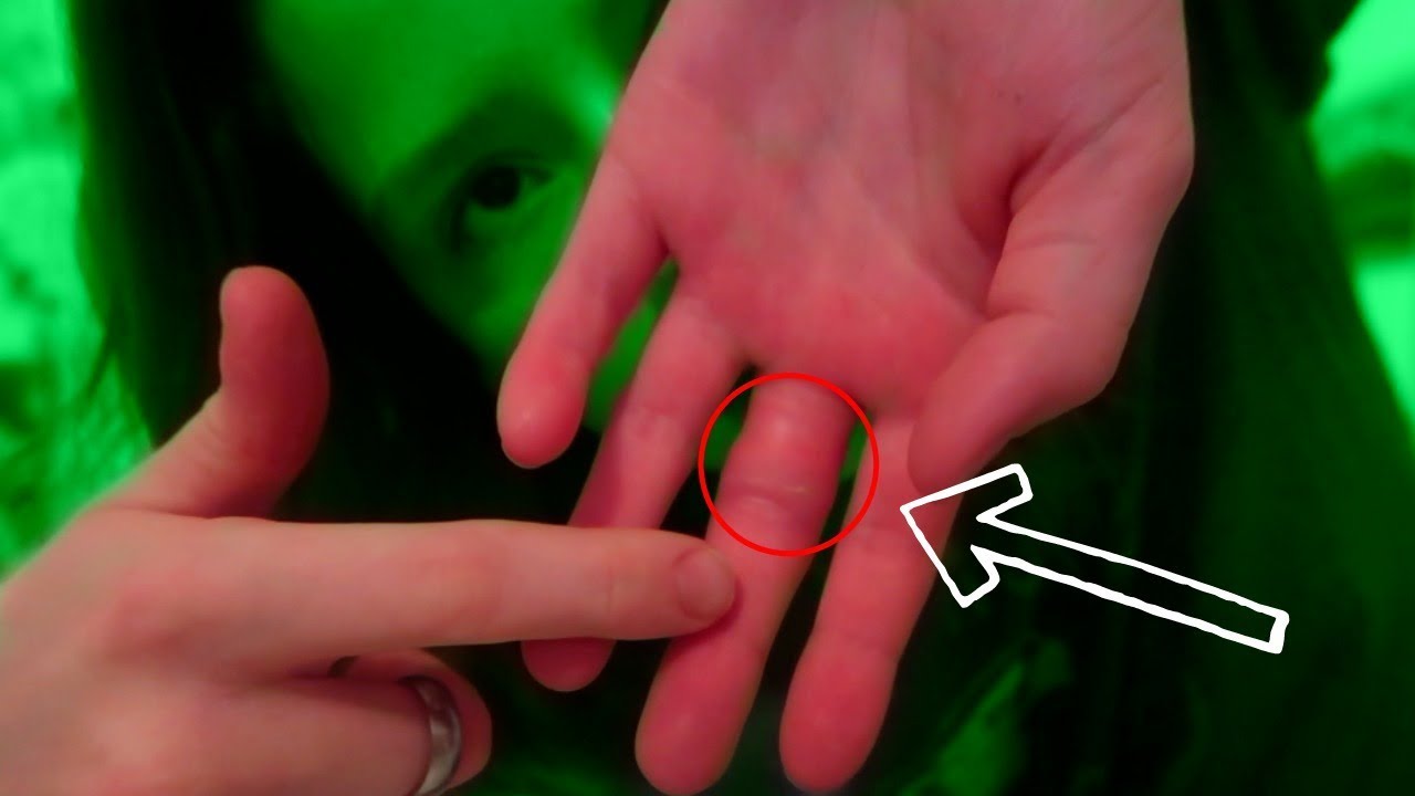 I THINK I SPRAINED MY FINGER!?!?!