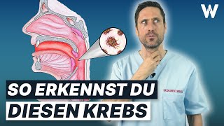 Speiseröhrenkrebs: Tödliche Gefahr für Alle! Warnzeichen sofort erkennen! by DoktorWeigl 160,877 views 1 month ago 15 minutes