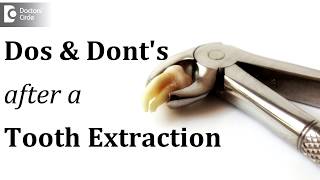 Dos and Dont's after a tooth extraction  Dr. Sathyadeep. V