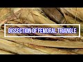 Dissection of Femoral Triangle