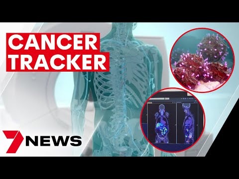 High-tech prostate cancer test helping save lives | 7news