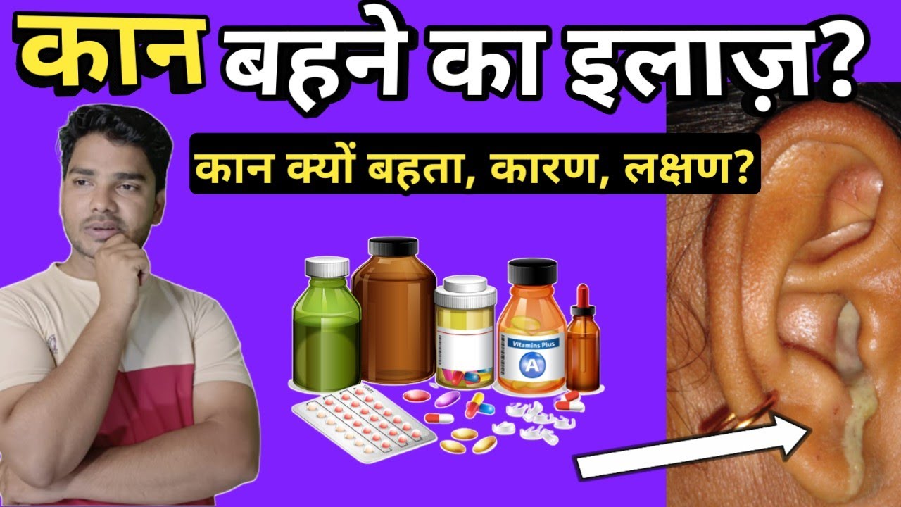 कान क्यों बहता है कारण और इलाज़ ? Ear Discharge Causes, Symptoms