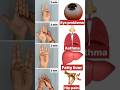 Powerful Mudras #eye #problems #asthma #fattyliver #hippain #shortsfeed #motivation #viralvideo