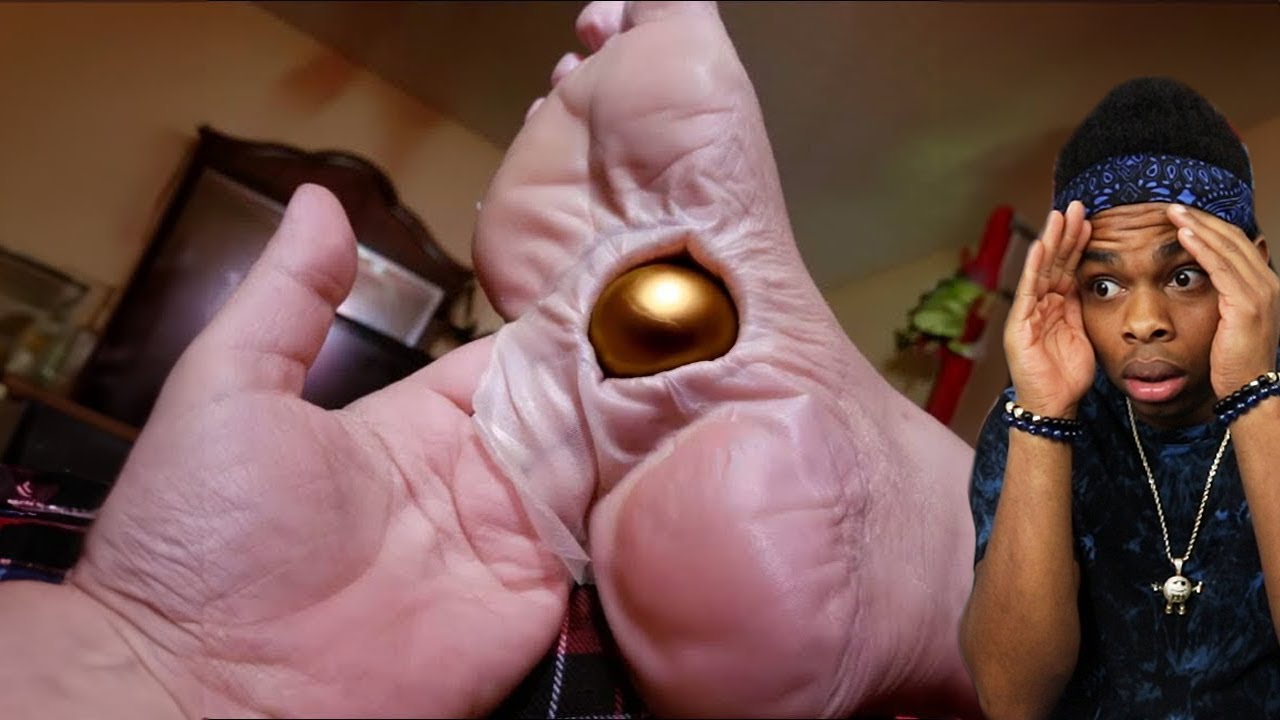 мяч застрял у него в ноге..