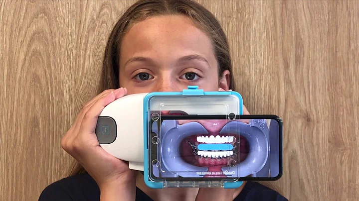Uitleg gebruik van de Dental Monitoring scanbox  K...