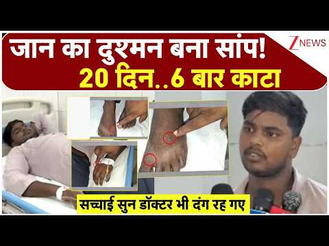 Etawah Snake Incident: जान का दुश्मन बना सांप!20 दिन..6 बार काटा, सच्चाई सुन डॉक्टर भी दंग रह गए
