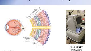 Glaucoma Progression Prediction Using Retinal Thickness via Latent Space Linear Regression