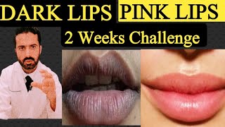 Lips Dark Spots and Lip Hyperpigmentation Treatment | Remove lip Dark spots at Home | Dr.Nadeem Rph