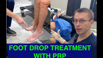 Foot Drop Treatment with PRP Injections - Stimulate Nerve Healing