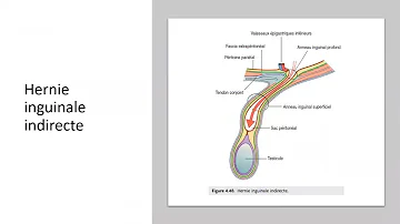 C'est quoi le canal inguinal ?