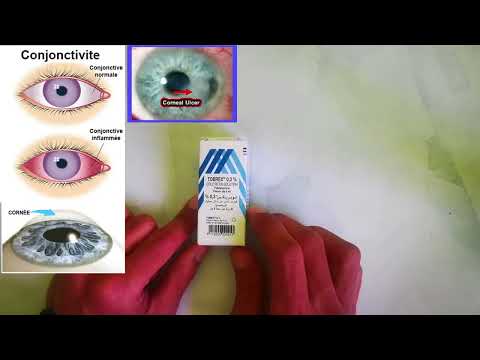 نصائح عند استعمال قطرات العين توبريكس 