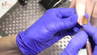 Наращивание ногтей Polygel (укрепление ногтей полигелем + аппаратная обработка кутикулы) Наращивание ногтей Polygel (укрепление ногтей полигелем + аппаратная обработка кутикулы)