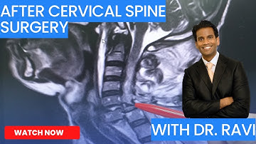 How To Recover From:  CERVICAL SPINE SURGERY post-operative instructions with Dr. RAVI