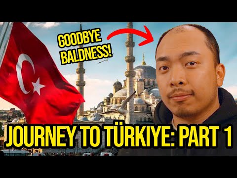 I Traveled To Turkiye For A Hair Transplant
