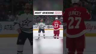 Download Lagu Most gruesome fight#youtubeshorts #hockey #humor #hockeyfun #hockeyfans #fight #customjersey MP3