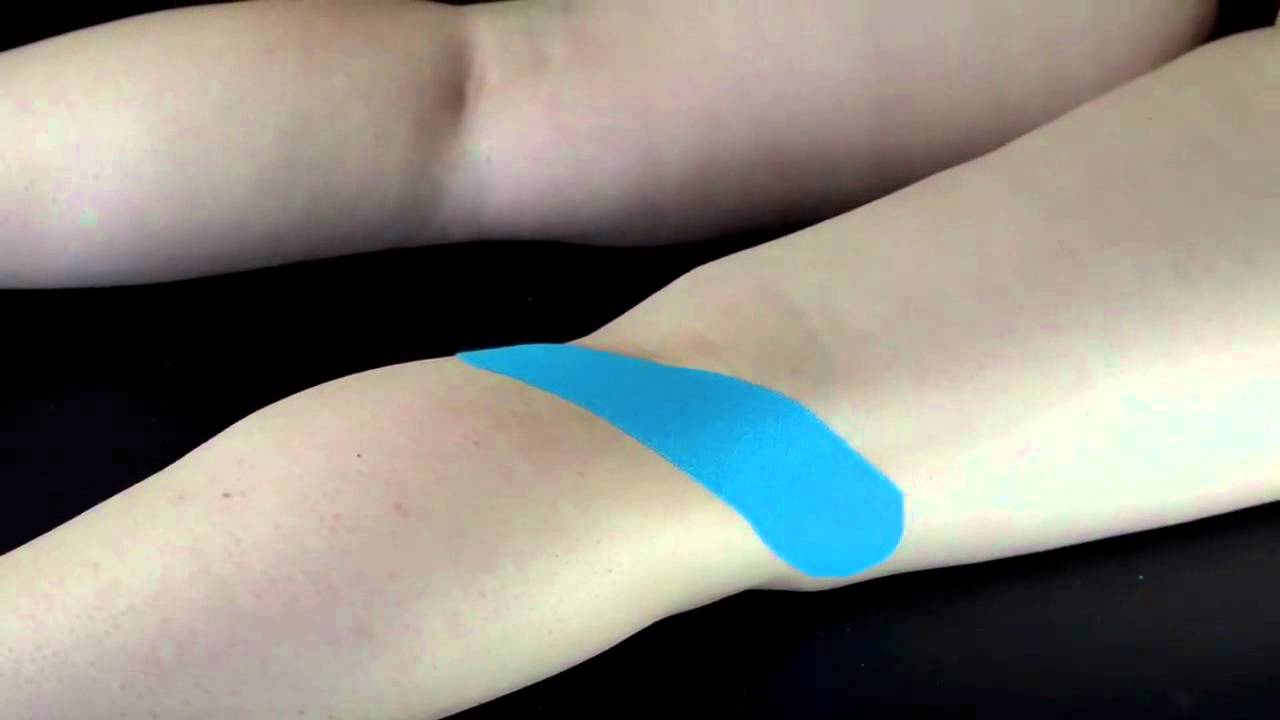 Knie Popliteus Syndroom YouTube