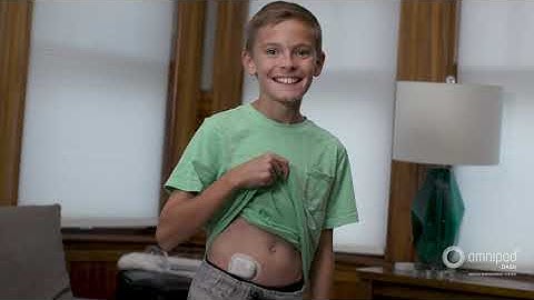 OmniPod Dash - Tubeless Insulin Pump- Testimonial Video