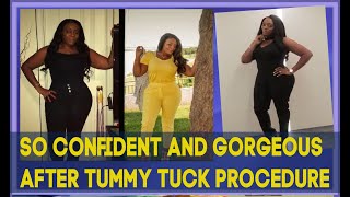 Super Mama's Amazingly Gorgeous Body After Tummy Tuck | Dr. Cortes