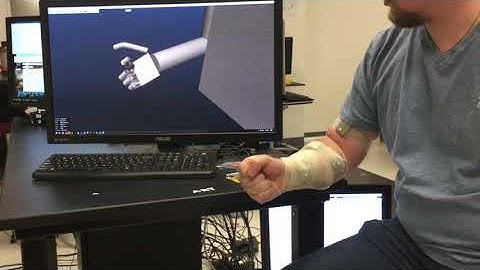 Biomimetic Control of Arm and Hand in Real-Time using surface EMGs