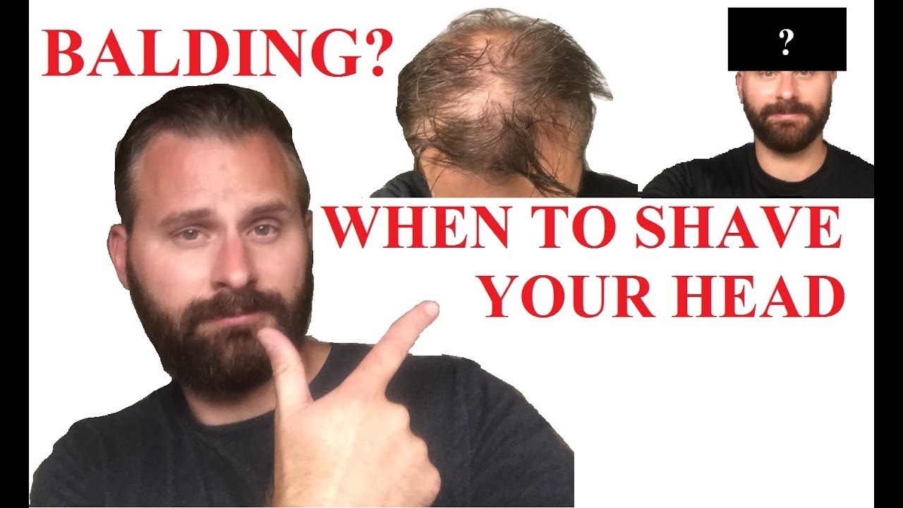 When To Shave Your Head When Going Bald Youtube
