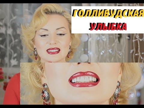 Vlog//ПОСТАВИЛА БЕЛЫЕ ВИНИРЫ//ГОЛЛИВУДСКАЯ УЛЫБКА ИЛИ УЛЫБКА НА МИЛЛИОН