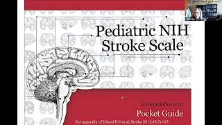 Dr Lori Jordan, MD- Pediatric stroke code and his risk population for stroke in the young