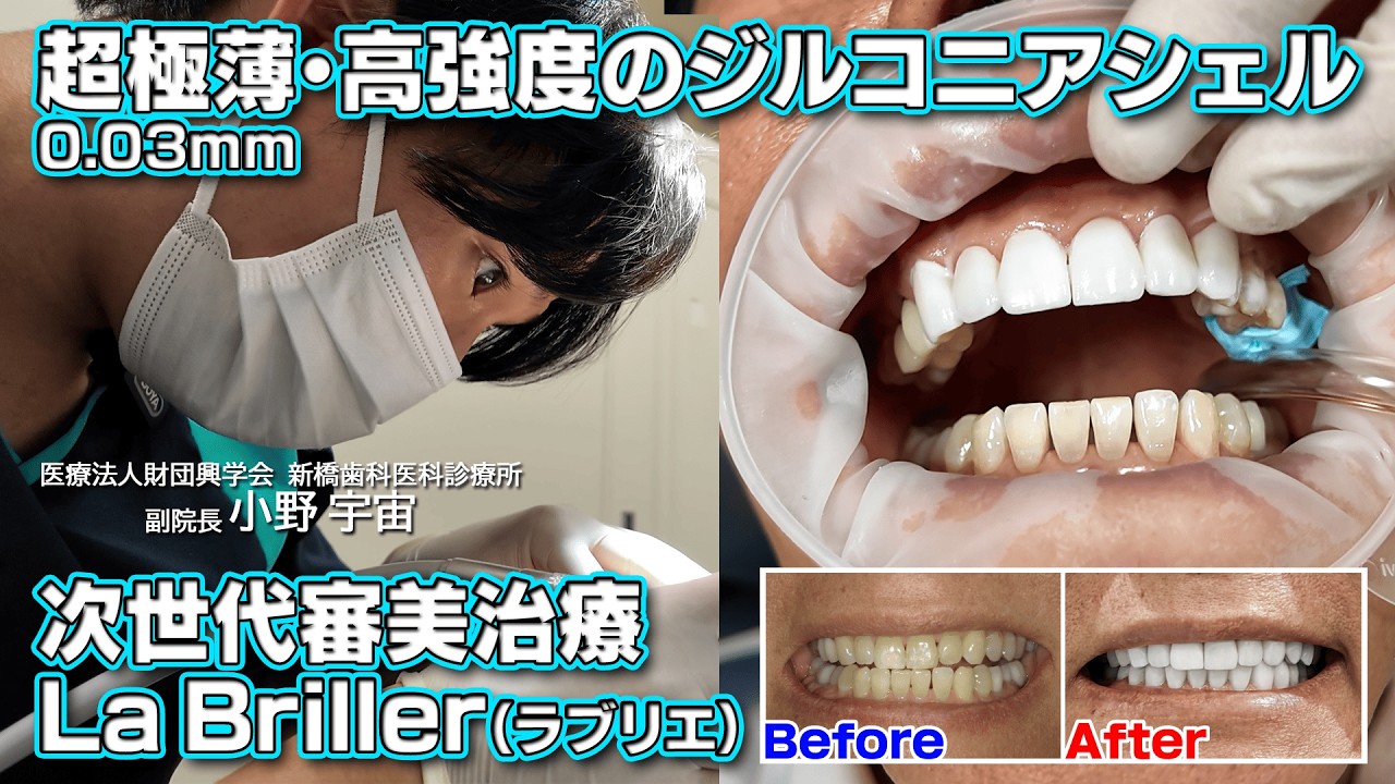 Esthetic Rehabilitation 審美歯科 マウロ フラデアーニ Esthetic