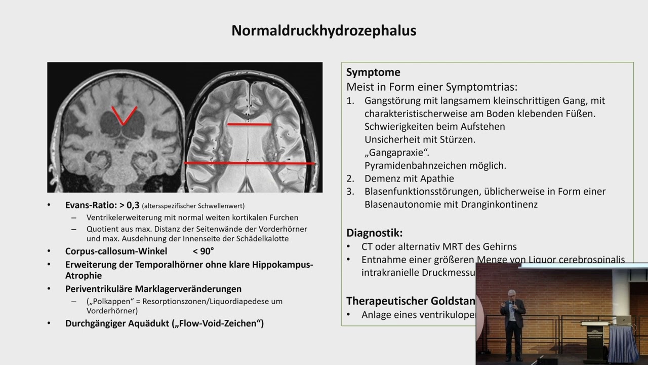 Vortrag „Differentialdiagnose idiopathischer Parkinson und atypisches Parkinson-Syndrom“