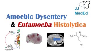 Amebiasis (Amoebic Dysentery) | Entamoeba histolytica, Pathogenesis, Signs & Symptoms, Treatment