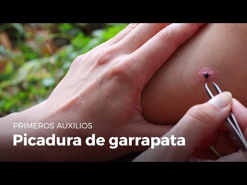 ¿Qué aspecto tiene una picadura de garrapata en un perro?