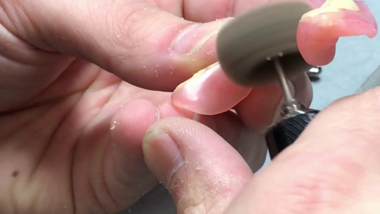 Adjusting & Polishing Valplast Chairside - by Drake Precision Dental Laboratory