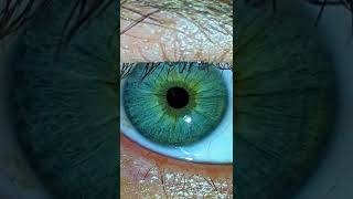 Iris Wobble