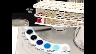 easySpiral Dilute - Automatic diluter and plater