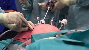 Robotchirurgie