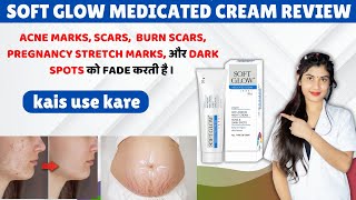 How is Soft Glow Cream? It cures all blemishes on the skin. How to use it? Side effects screenshot 2